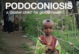 Graphic publicising inaugural lecture titled: Podoconiosis. A 'poster child' for global health?, featuring a young child in the foreground